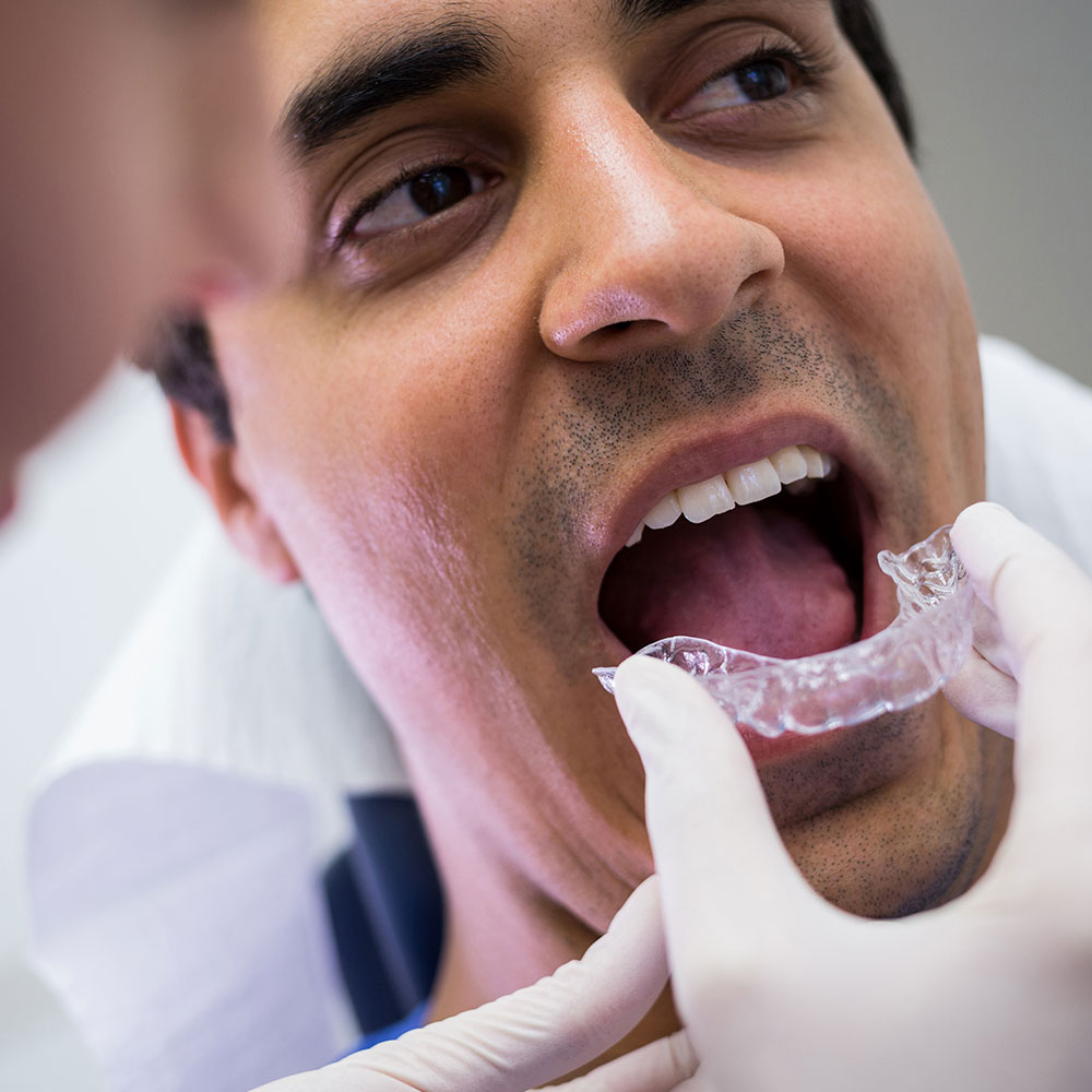 Clear aligners and invisible braces in Gurgaon managed by MDS Orthodontist Dr. Amit Aneja, Basil Dental Clinic