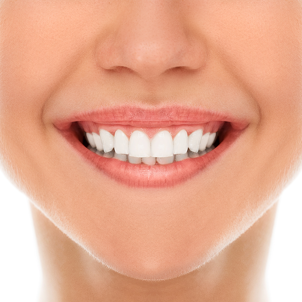 Smile design and cosmetic dentistry makeover in Gurgaon at Basil Dental Clinic, Sector 82A